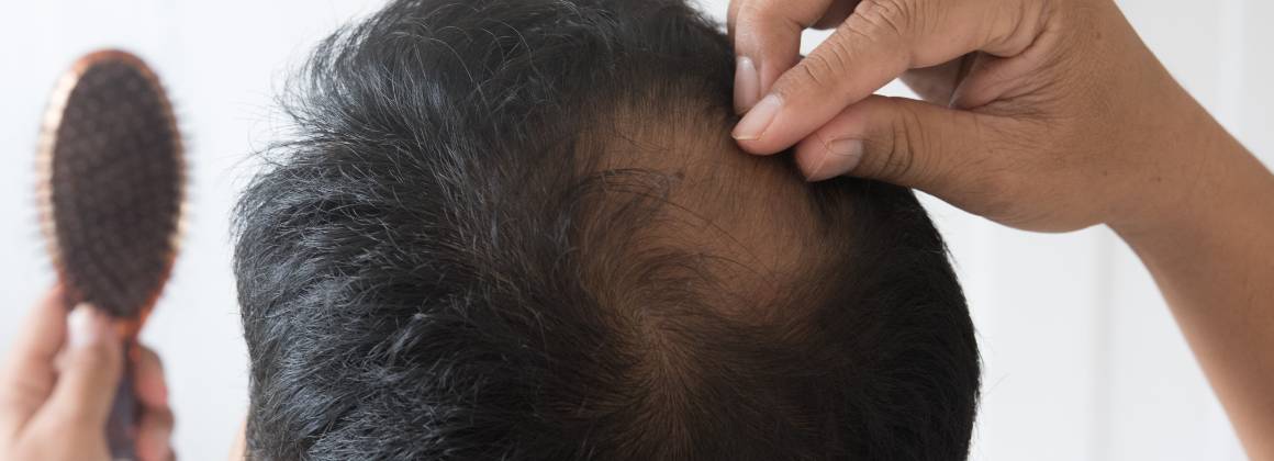 Ce cauzează subțierea părului și căderea părului?