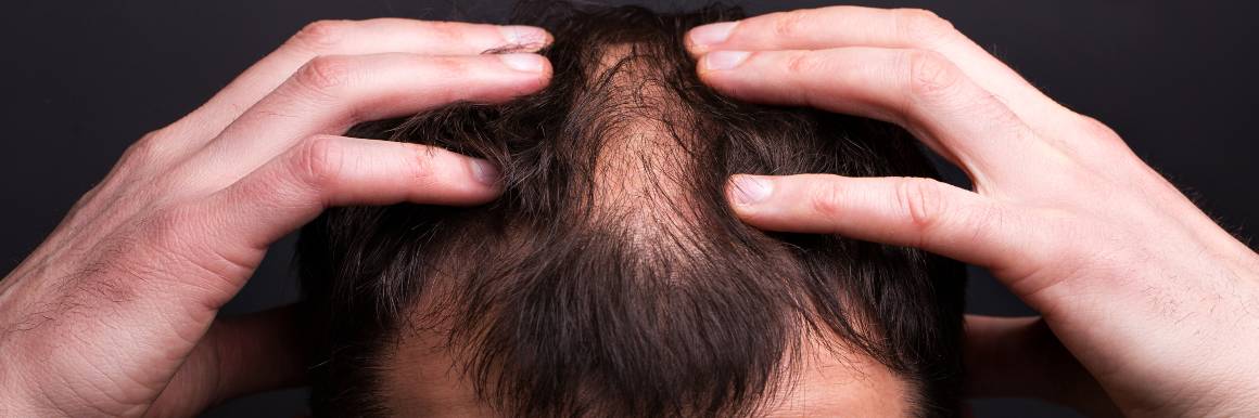 Repararea foliculilor de păr deteriorați pentru o creștere sănătoasă a părului